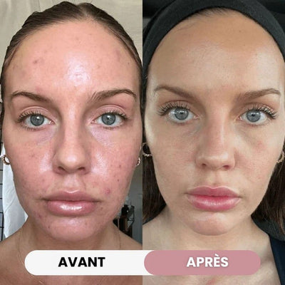 Crème Hydratante