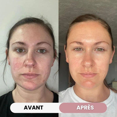 Crème Hydratante